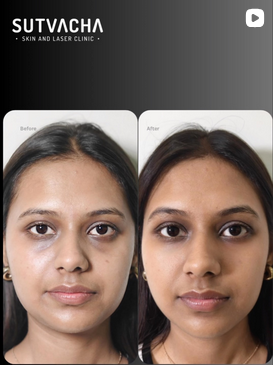 Why Skincare is better for your body