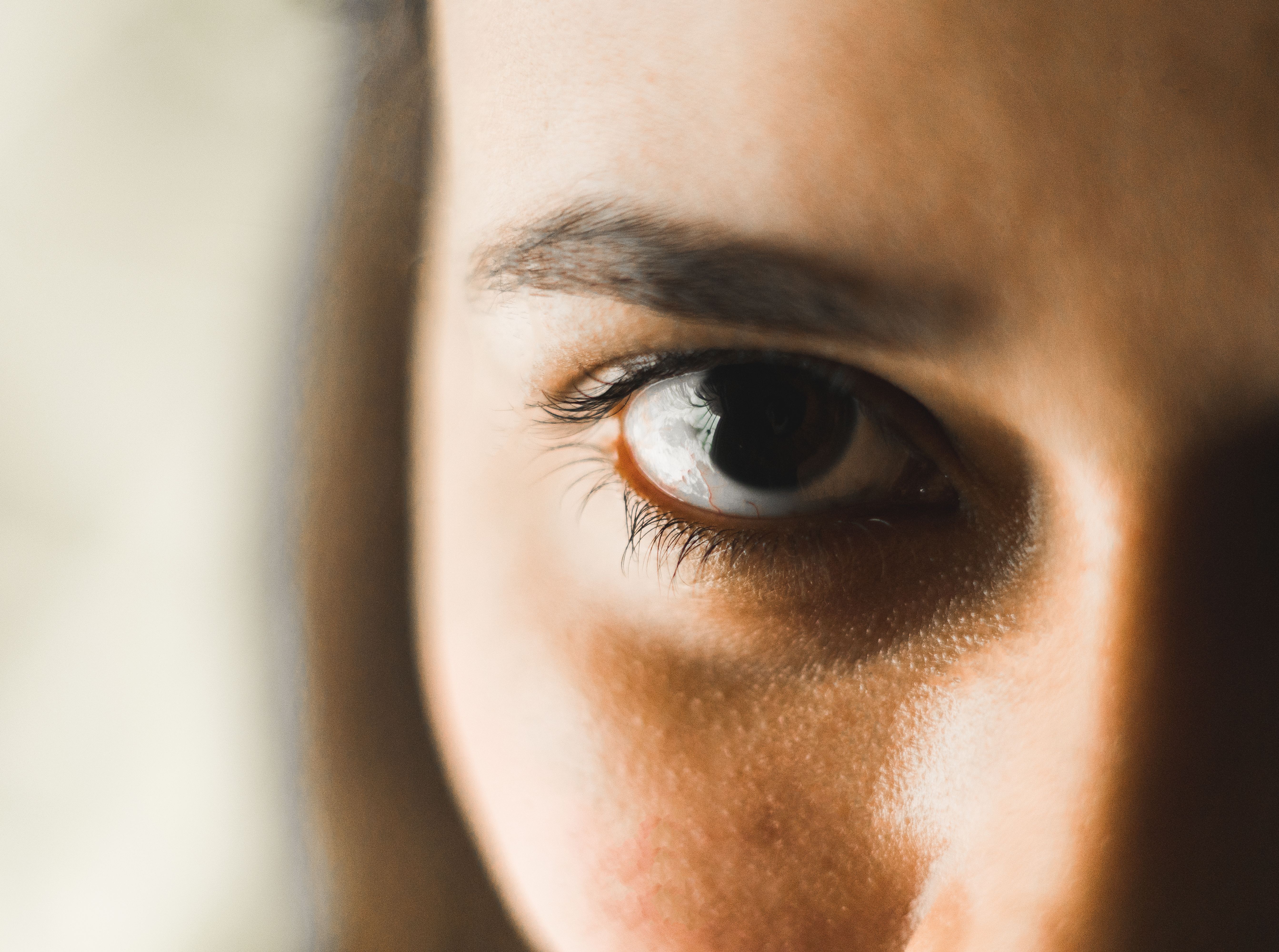 Dark Circles Aren't All the Same: Understanding What Causes Them