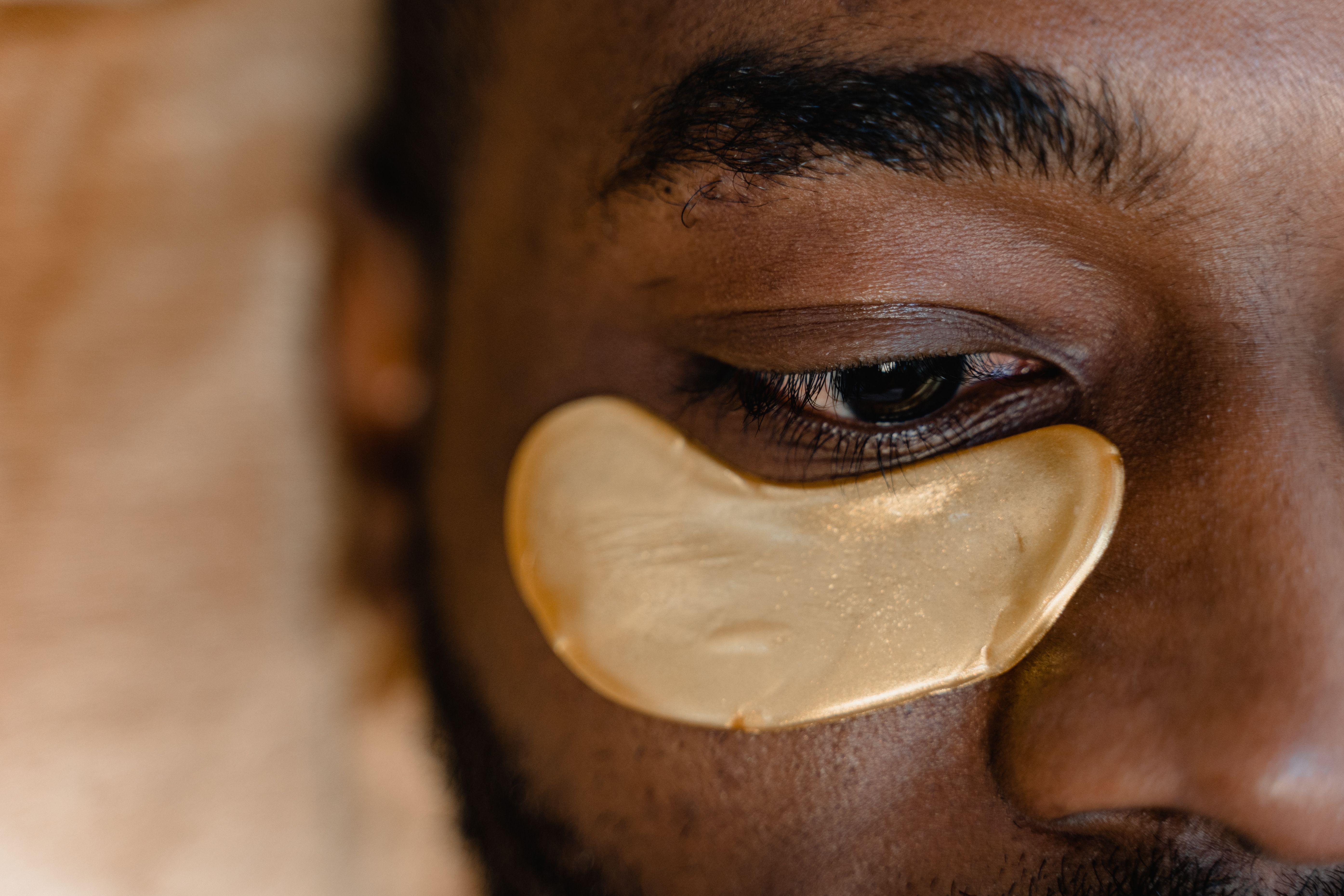 Can Laser Treatment Reduce Dark Circles? What You Should Know